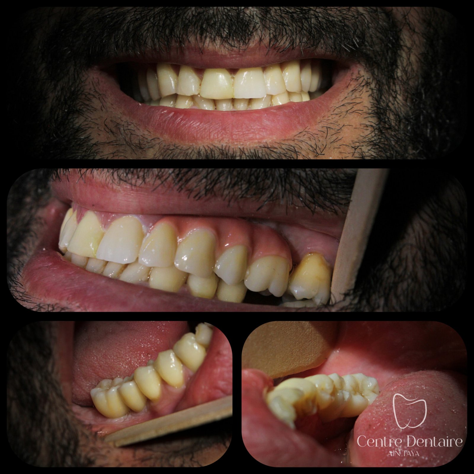 InShot_20250518_184205294