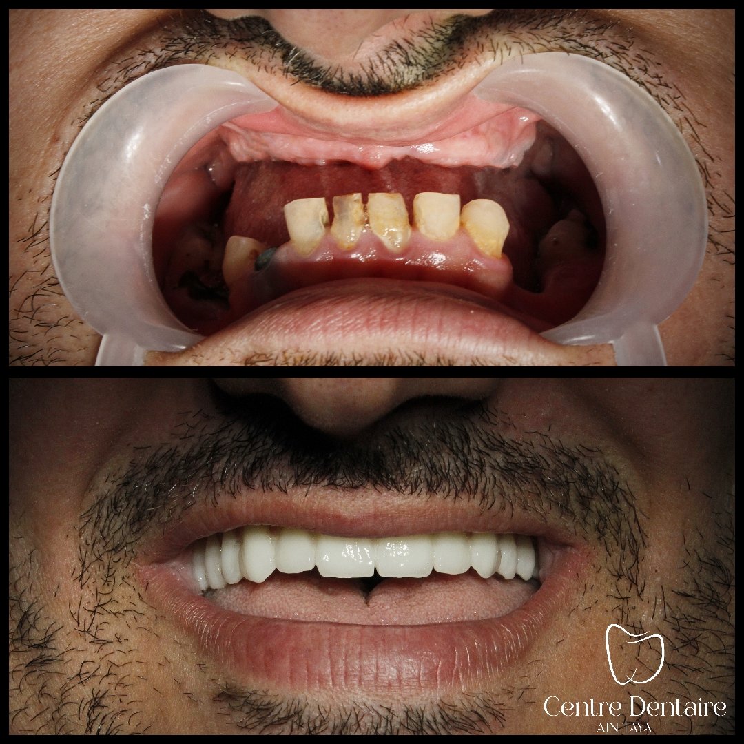 MyImage-1756658162-00