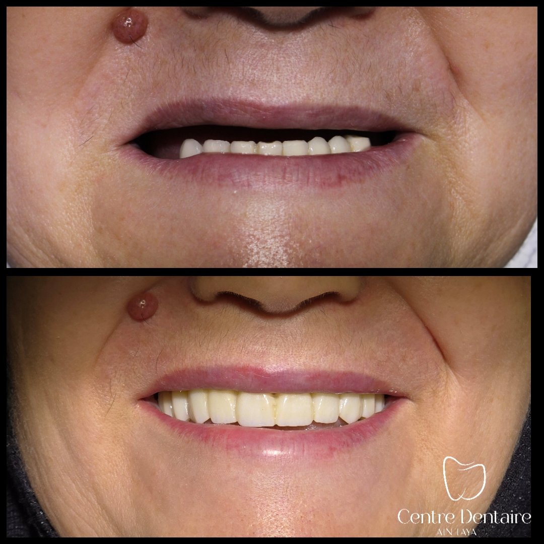 MyImage-1759686141-00