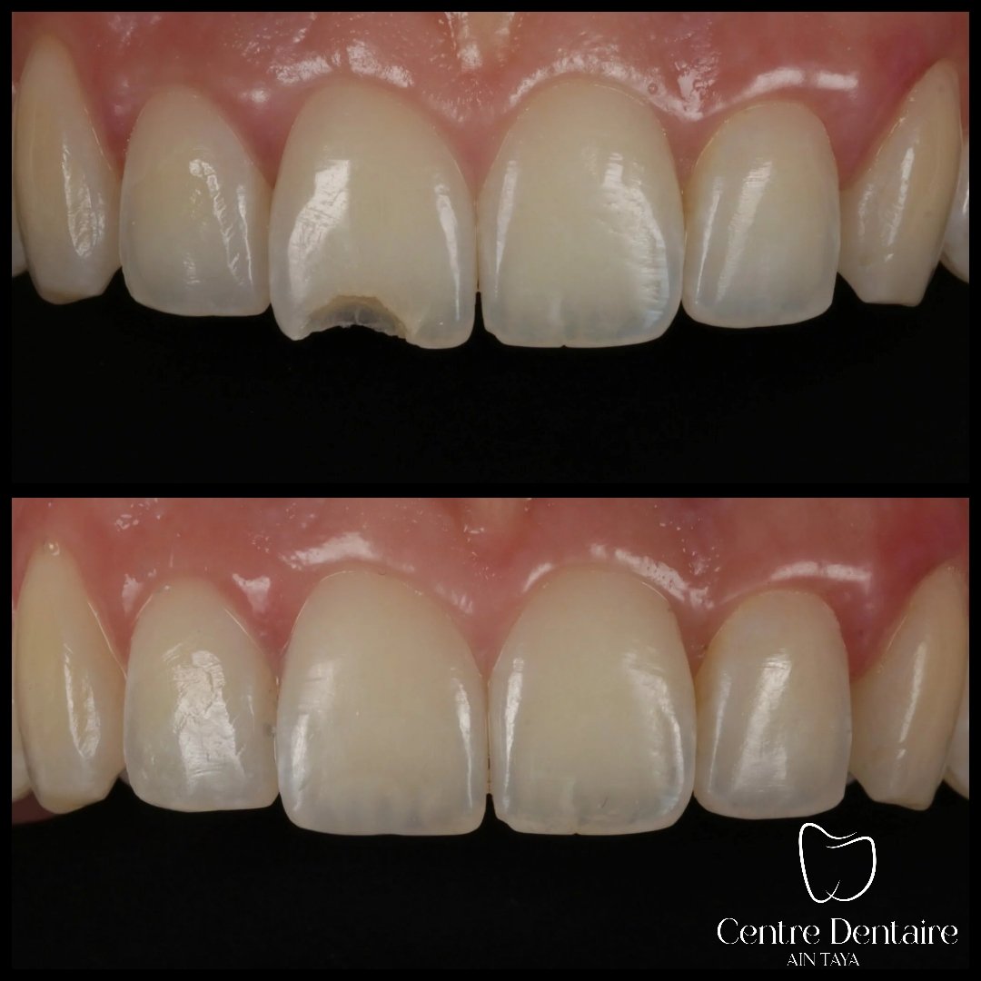 MyImage-1768242203-00