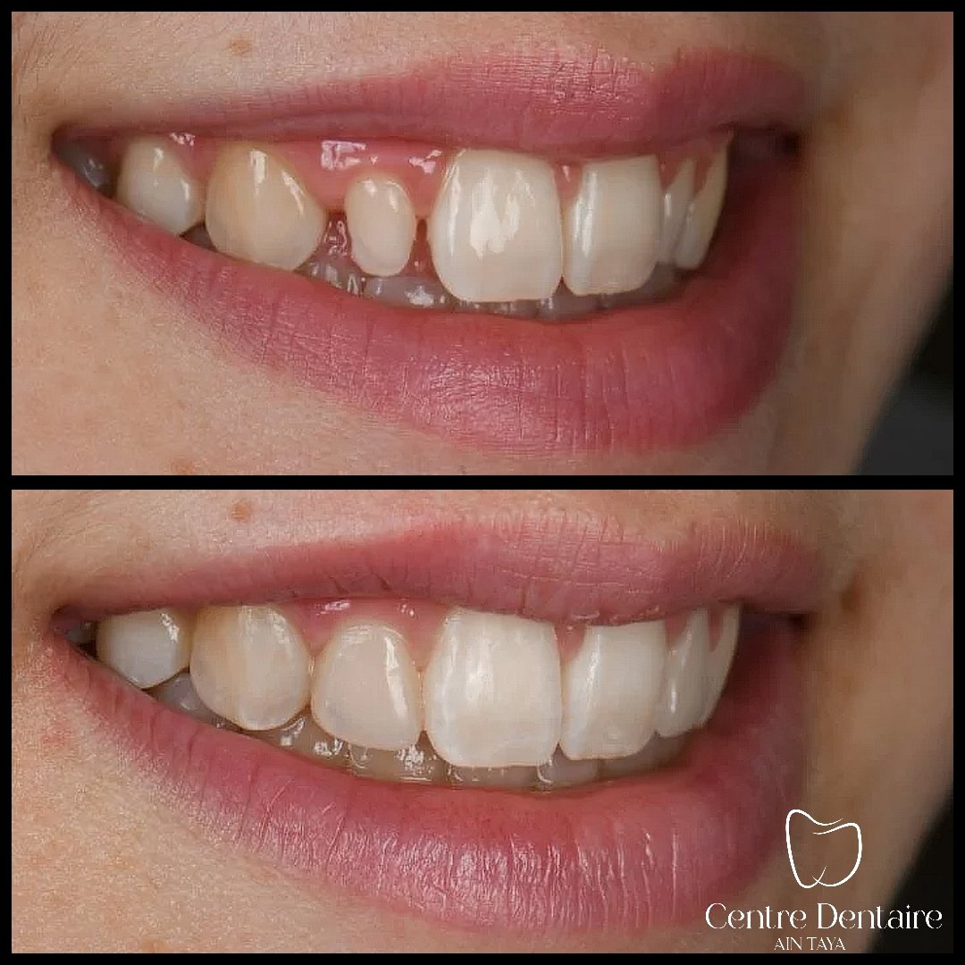 MyImage-1768243909-00