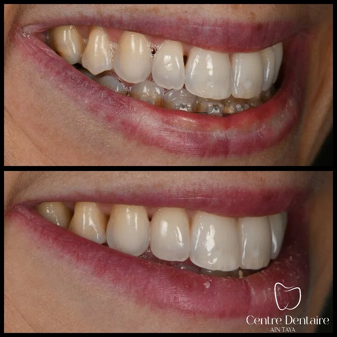 MyImage-1768243945-00