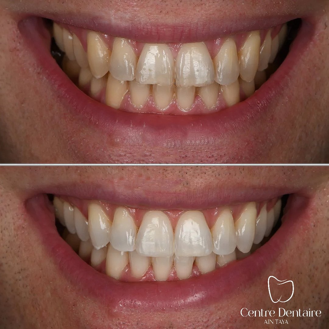 MyImage-1768243974-00