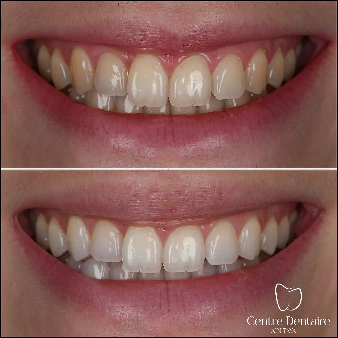 MyImage-1768244011-00