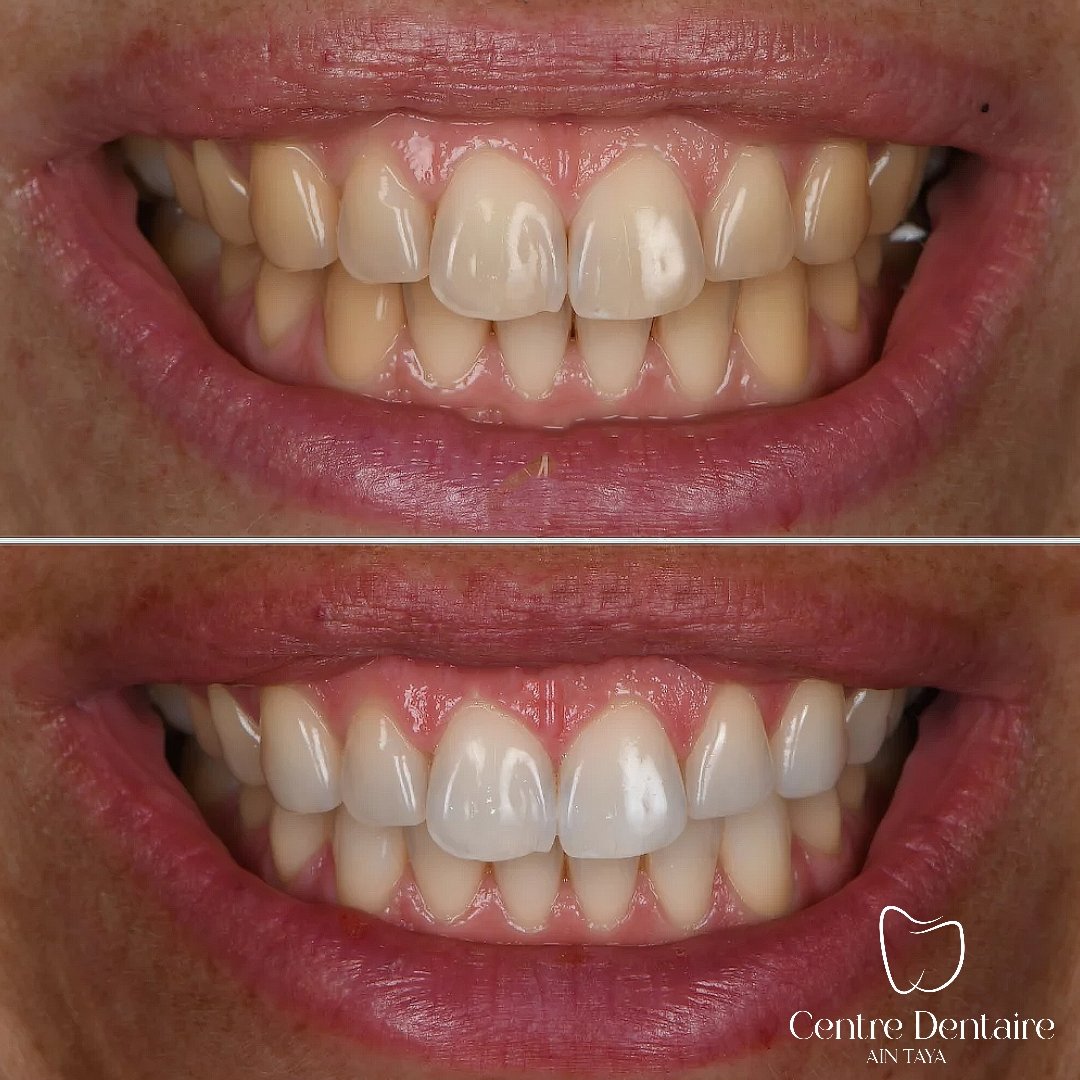 MyImage-1768244045-00