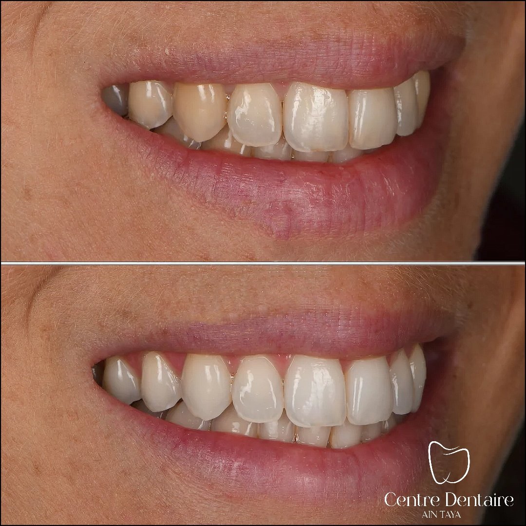 MyImage-1768244077-00