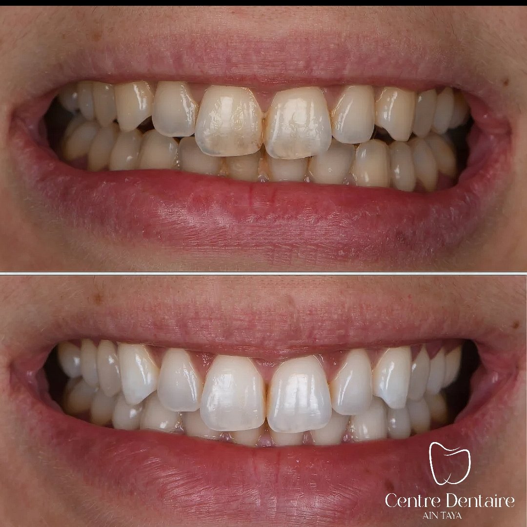 MyImage-1768244112-00